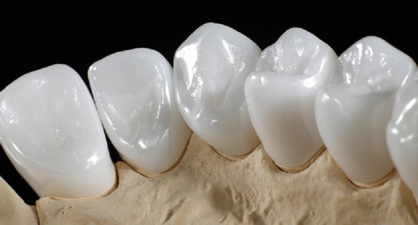 Nha khoa Nhân Tâm chỉ sử dụng các loại răng sứ chính hãng chất lượng cao