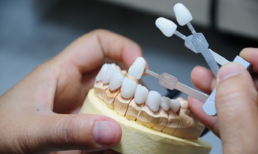 So sánh răng sứ Cercon và Emax: Ưu và nhược điểm