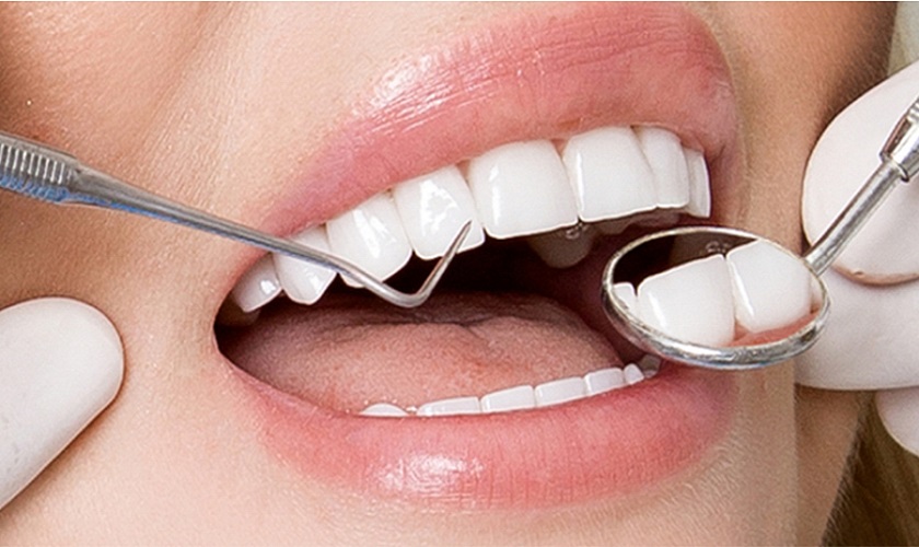 Hiệu quả phục hình của răng sứ kim loại và răng toàn sứ gần như tương đương nhau