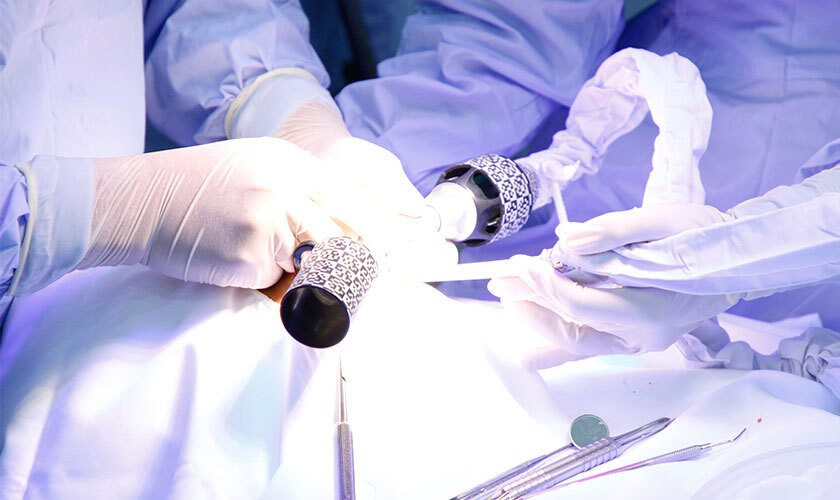 Quá trình đặt implant diễn ra rất nhanh chóng nhờ công nghệ định vị