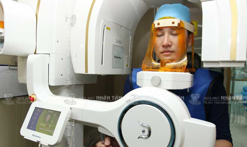 Miễn phí chụp X-quang Conebeam CT 3D Miễn phí chụp X-quang Conebeam CT 3D