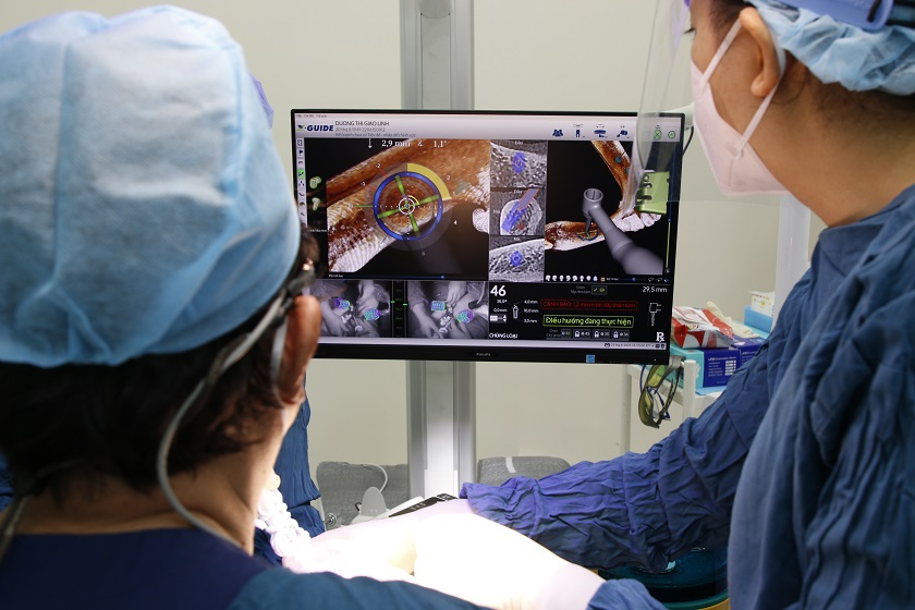 Hệ thống giám sát bằng thị giác cho phép bác sĩ quan sát tất cả hoạt động của mũi khoan trong xương hàm