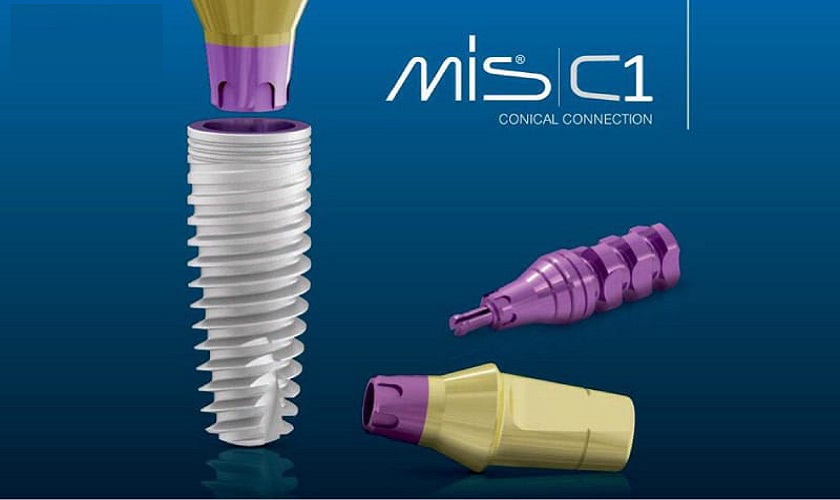 Tìm hiểu cấu tạo, ưu điểm và trường hợp nên cấy Implant MIS C1