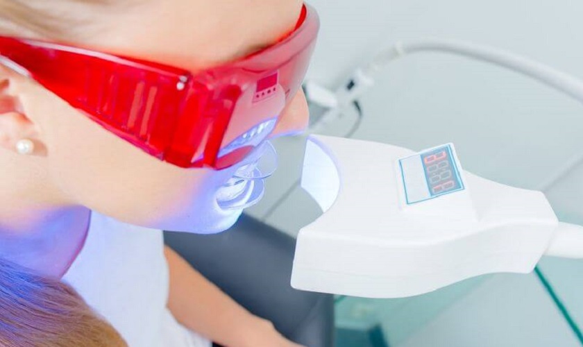 Công nghệ tẩy trắng răng Laser Whitening