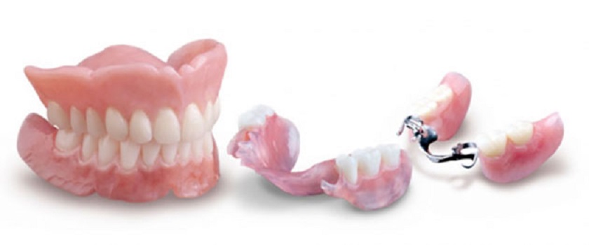 Răng giả tháo lắp phục hình răng đã mất