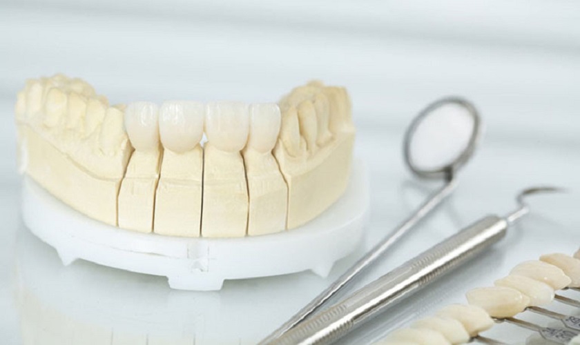 Trồng răng giả có ảnh hưởng gì tới sức khỏe không?