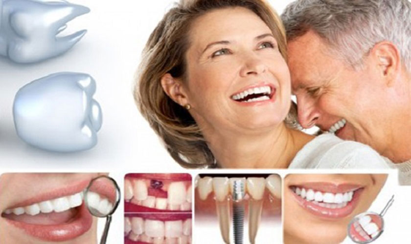 Trồng răng Implant cho cha mẹ với X-Guide công nghệ định vị