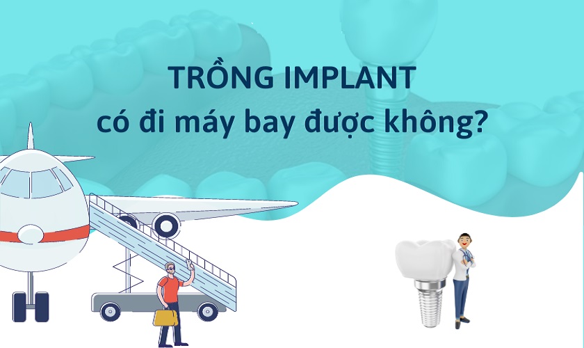[Hỏi&Đáp] Trồng răng Implant có đi máy bay được không?