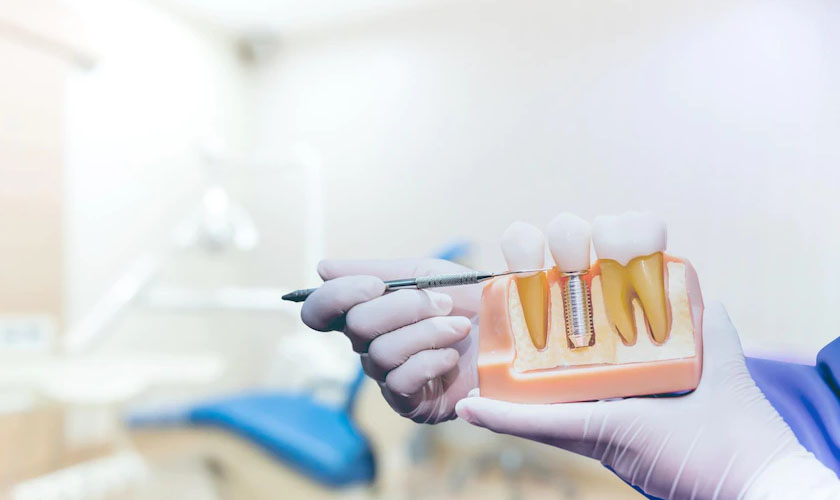 Cấy ghép răng Implant có nguy hiểm không?