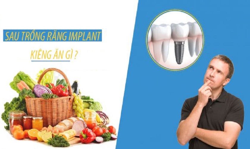 Bạn đã nắm rõ trồng răng Implant kiêng ăn gì chưa?