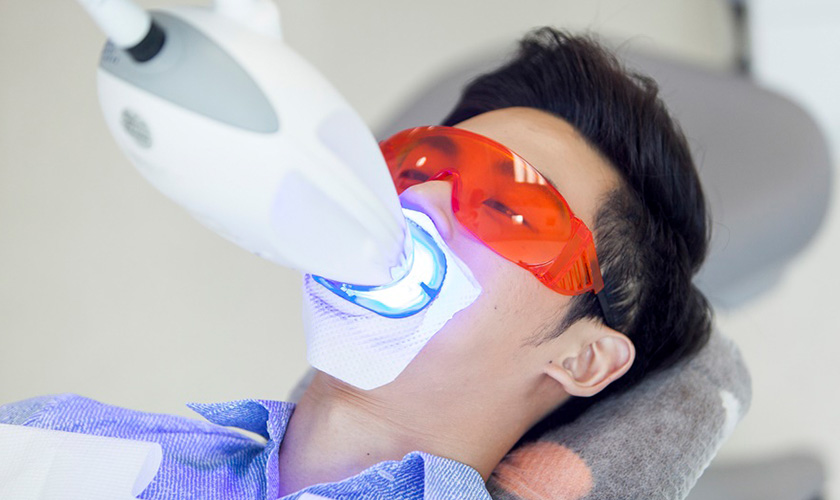 Quá trình tẩy trắng răng bằng Laser Whitening