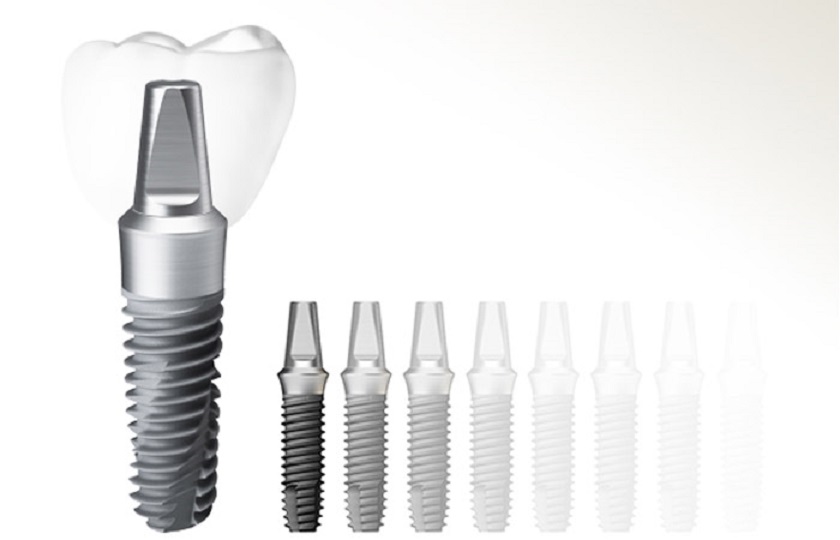 Vật liệu cấy ghép là yếu tố ảnh hưởng đến giá cả làm răng Implant