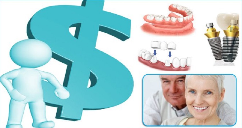 Giá cả làm răng Implant tại cơ sở nha khoa uy tín