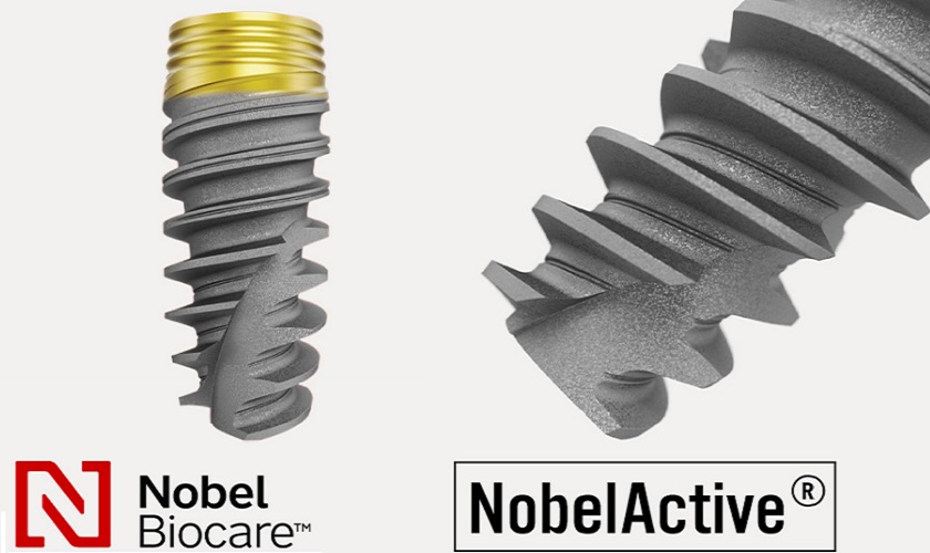 Trụ Implant Nobel Biocare Active có xuất xứ và giá thành như thế nào?