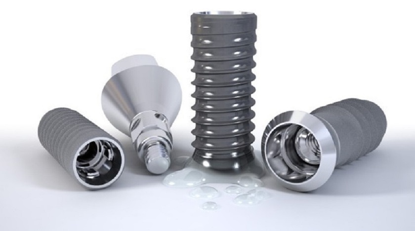 Loại trụ Implant sử dụng cũng sẽ ảnh hưởng đến thời gian điều trị Loại trụ Implant sử dụng cũng sẽ ảnh hưởng đến thời gian điều trị