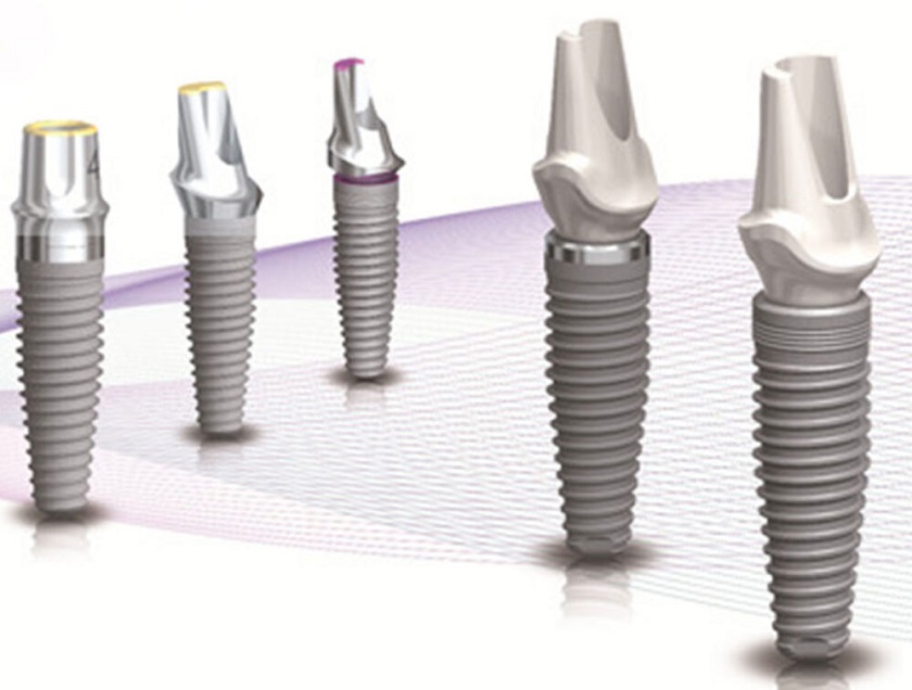 Nên lựa chọn các loại Implant đường kính nhỏ để cấy Implant cho vùng răng cửa Nên lựa chọn các loại Implant đường kính nhỏ để cấy Implant cho vùng răng cửa