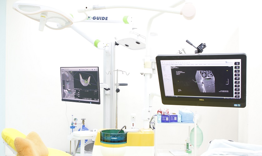 Công nghệ định vị cấy ghép Implant hiện đại tại Nhân Tâm