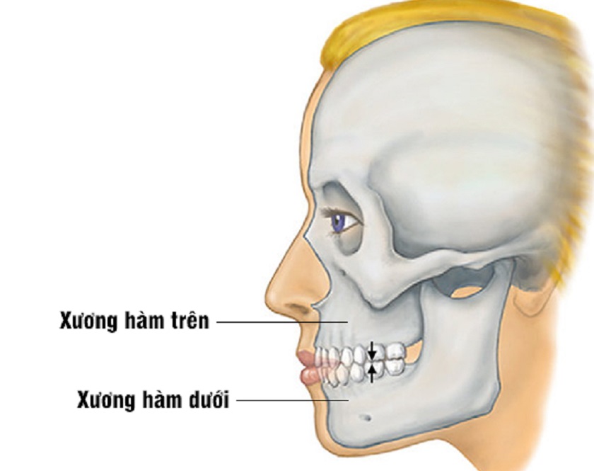 Implant nha khoa chỉ phù hợp khi xương hàm phát triển hoàn thiện