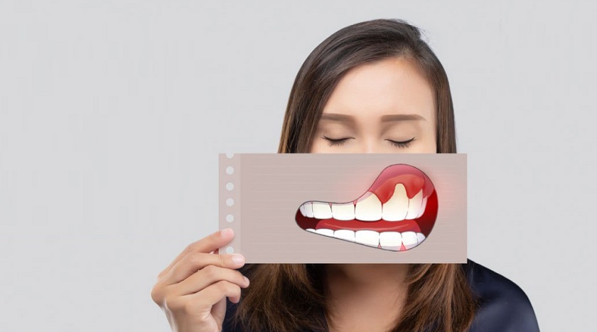 Gãy răng làm tăng nguy cơ mắc các bệnh lý liên quan đến răng miệng