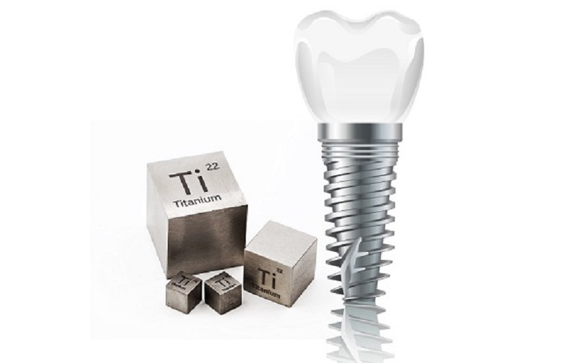 Một số trường hợp hi hữu có thể bị dị ứng với chất liệu Titanium sản xuất trụ Implant