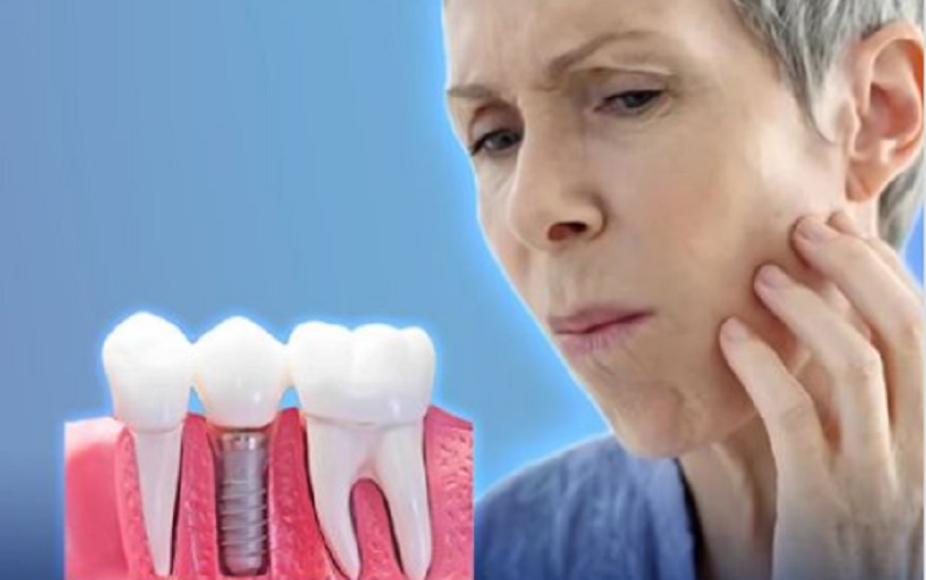 Răng Implant bị đau nhức kéo dài có thể là dấu hiệu cảnh báo nhiều biến chứng nguy hiểm