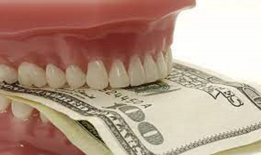 Chi phí cũng là một yếu tố quyết định nên trồng răng Implant loại nào