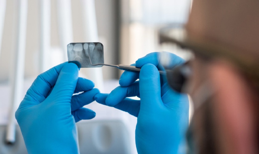 Trồng răng Implant chi phí bao nhiêu?