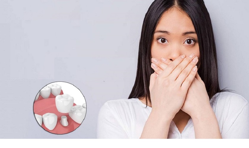 Trồng răng Implant có bị hôi miệng không? Nguyên nhân và khắc phục