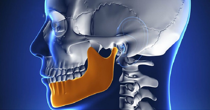 Cần ghép xương nếu xương hàm có chất lượng kém