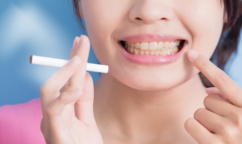 Hút thuốc lá gây ảnh hưởng nghiêm trọng đến trồng răng Implant