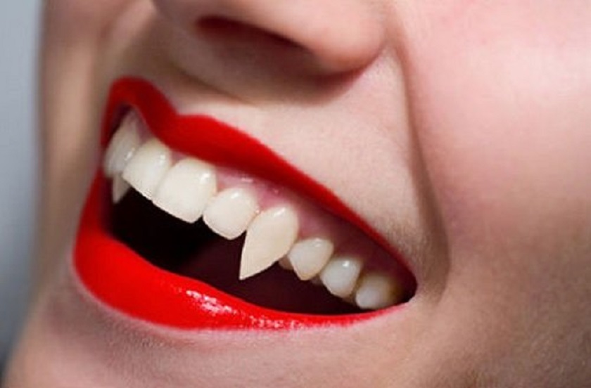 Răng nanh là gì