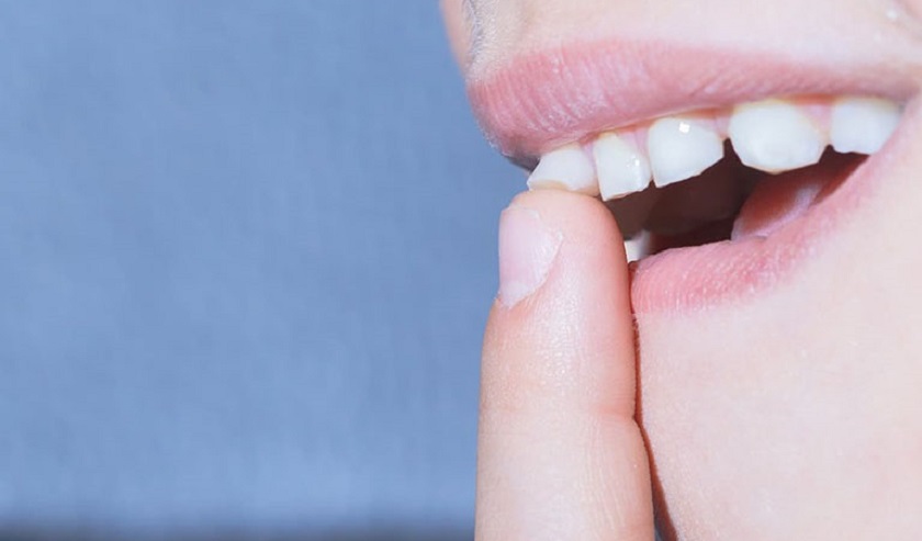 Lượng canxi sụt giảm khiến răng yếu dần và lung lay