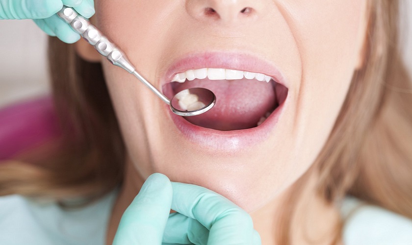 Sức khỏe răng miệng của khách hàng chi phối rất nhiều tới tuổi thọ của răng sứ