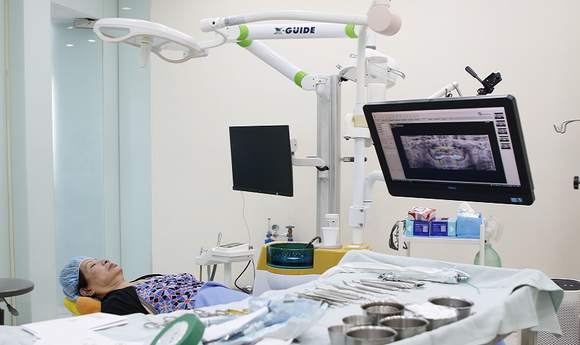 Ứng dụng máy công nghệ định vị X-Guide trong phẫu thuật trồng răng Implant