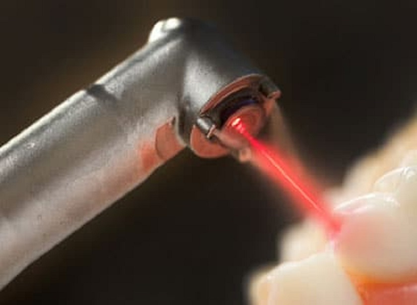 Liệu pháp quang động laser Helbo