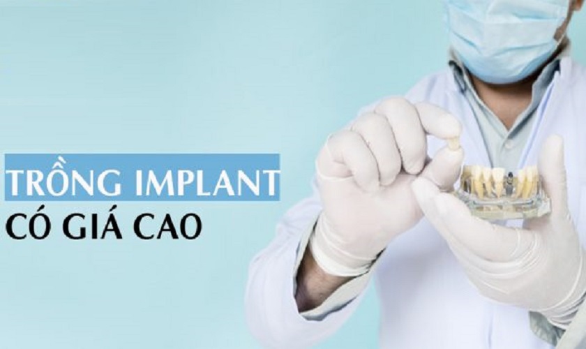 Chi phí cấy Implant ở mức tương đối cao